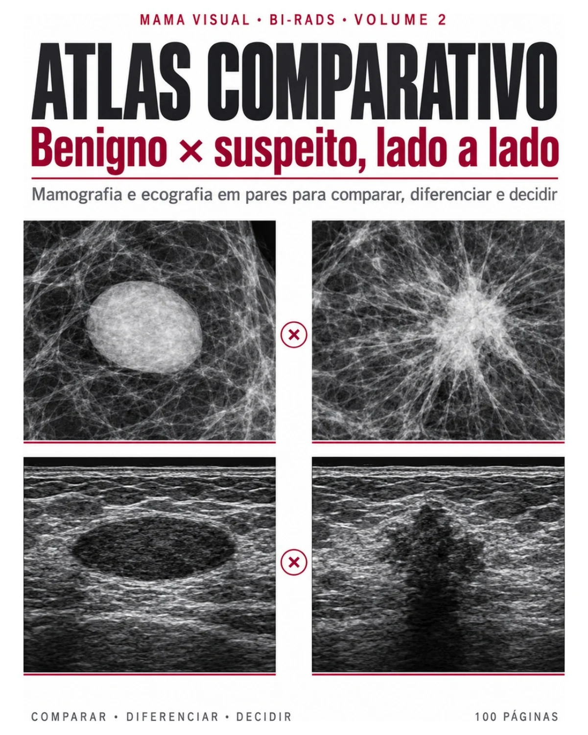 Capa do PDF: Atlas Comparativo: Benigno × Suspeito