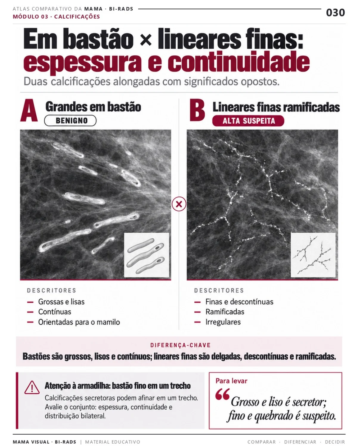 Página 30: Calcificações: espessura e continuidade. Prévia do PDF Mama Visual BI-RADS; imagens didáticas simuladas.