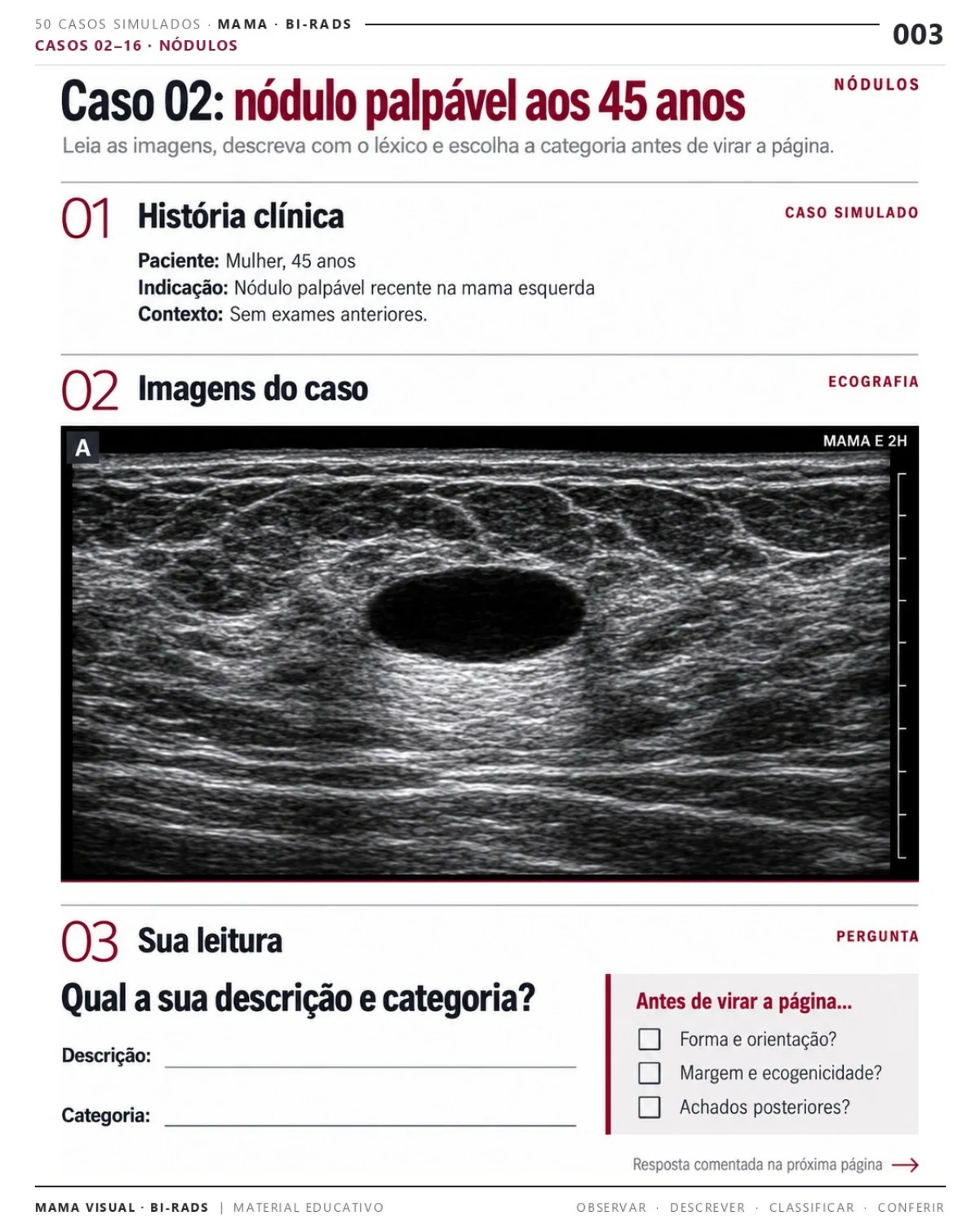 Página 3: Caso 02: nódulo palpável aos 45 anos. Prévia do PDF Mama Visual BI-RADS; imagens didáticas simuladas.