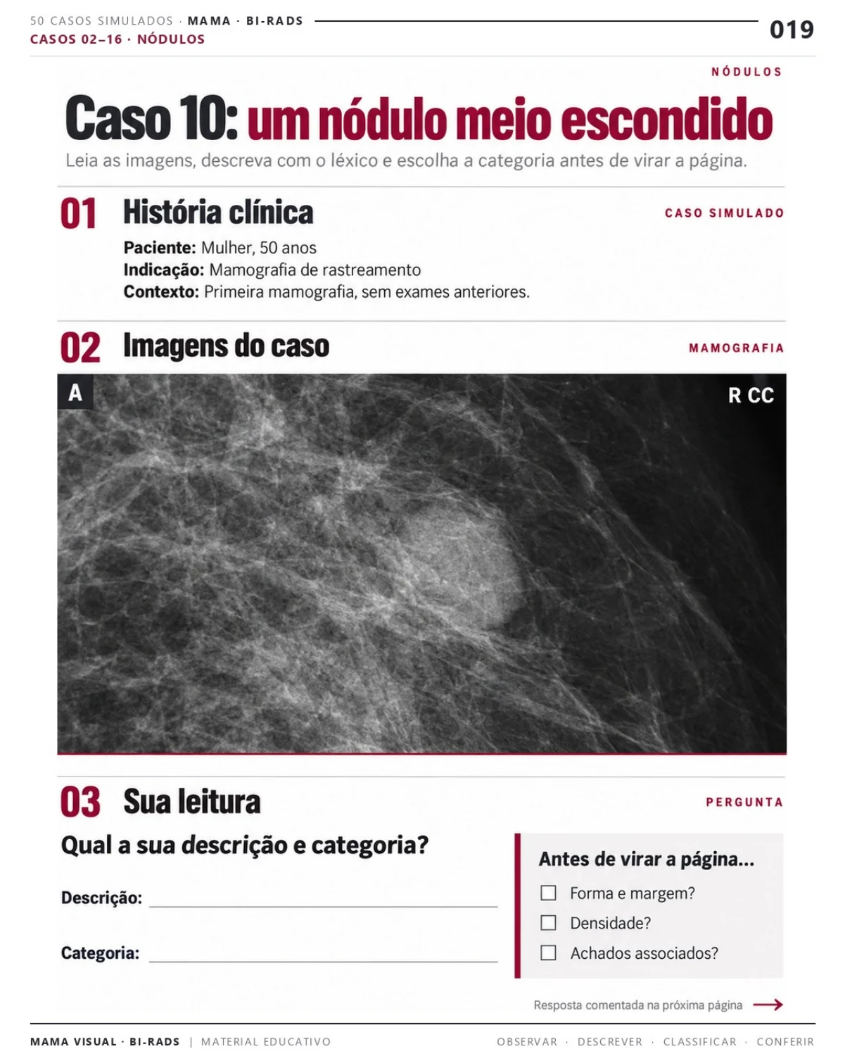 Página 19: Caso 10: um nódulo meio escondido. Prévia do PDF Mama Visual BI-RADS; imagens didáticas simuladas.