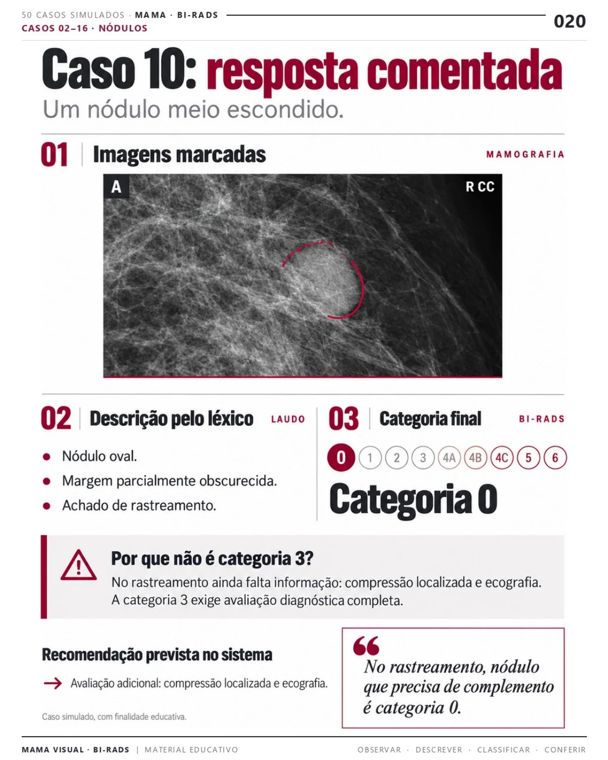 Página 20: Caso 10: resposta comentada. Prévia do PDF Mama Visual BI-RADS; imagens didáticas simuladas.