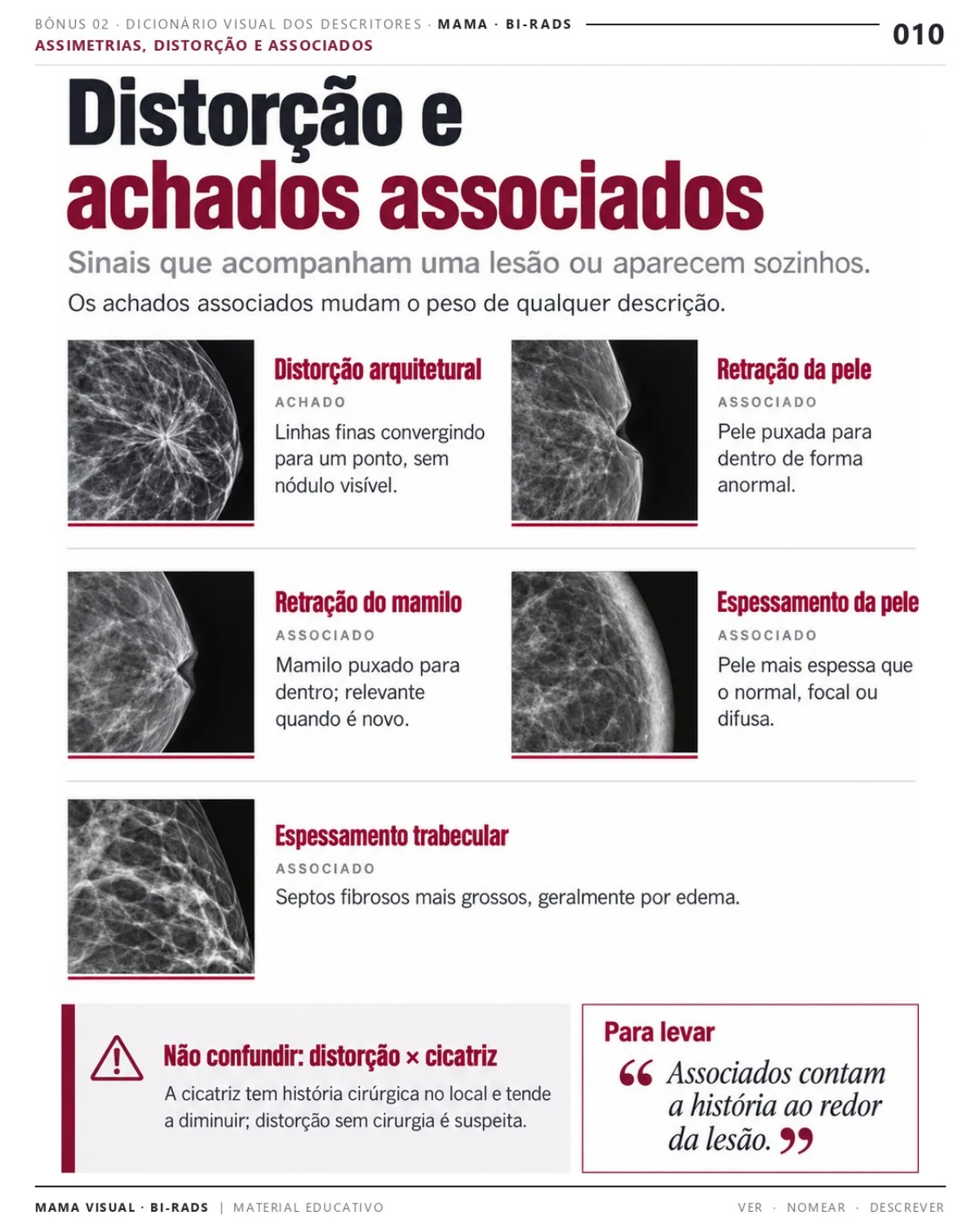 Página 10: Distorção e achados associados. Prévia do PDF Mama Visual BI-RADS; imagens didáticas simuladas.