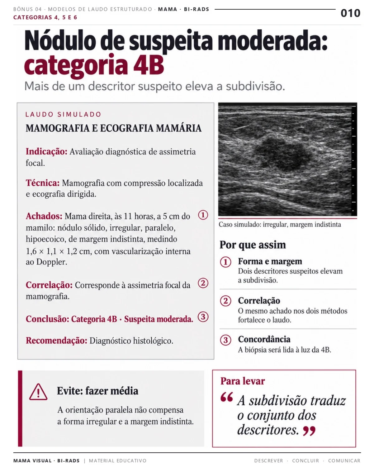 Página 10: Exemplo de laudo: categoria 4B. Prévia do PDF Mama Visual BI-RADS; imagens didáticas simuladas.